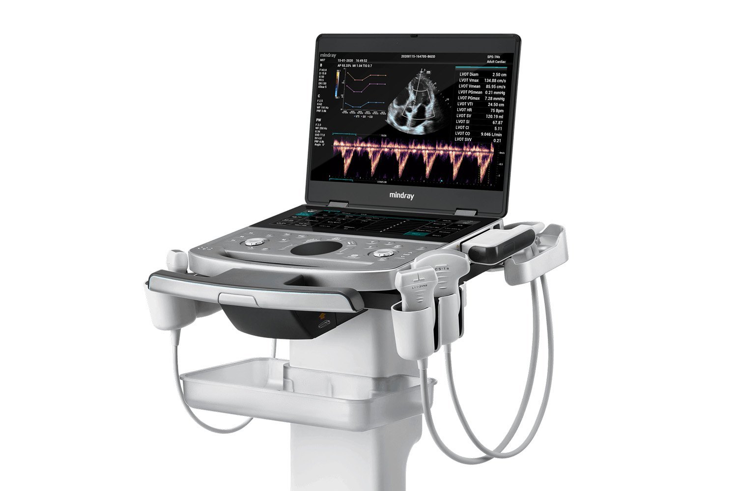 Mindray Z60 diagnostic ultrasound system - genuine Mindray product sold by Triglav Healthcare